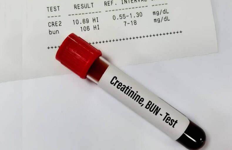 7 Problemas de Salud por falta de Creatina