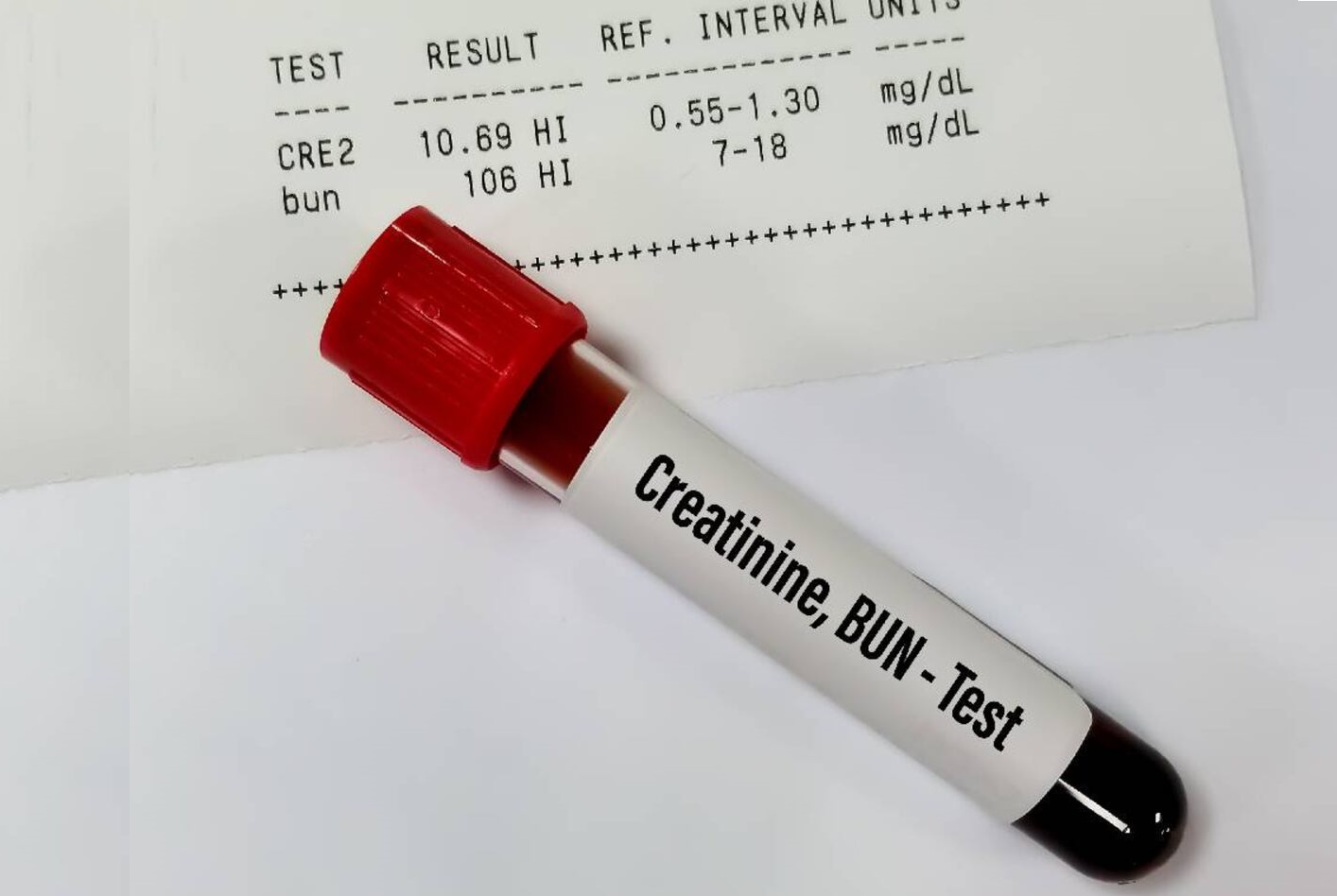 7 Problemas de Salud por falta de Creatina