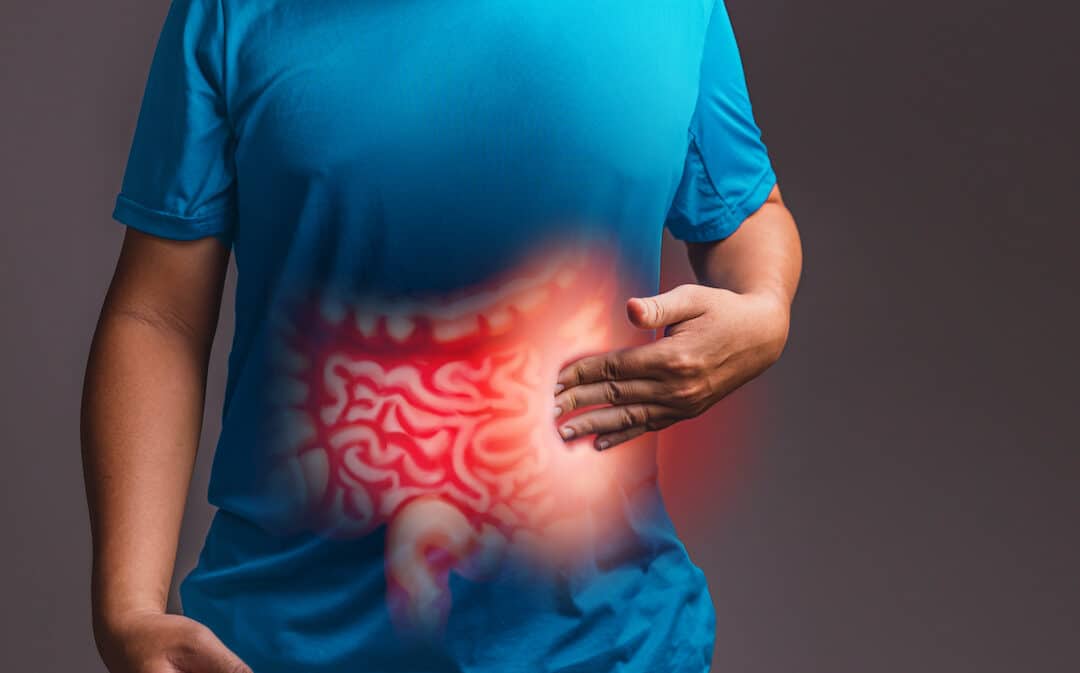 Psyllium y su magnifica eficacia en Sindrome de Intestino Irritable